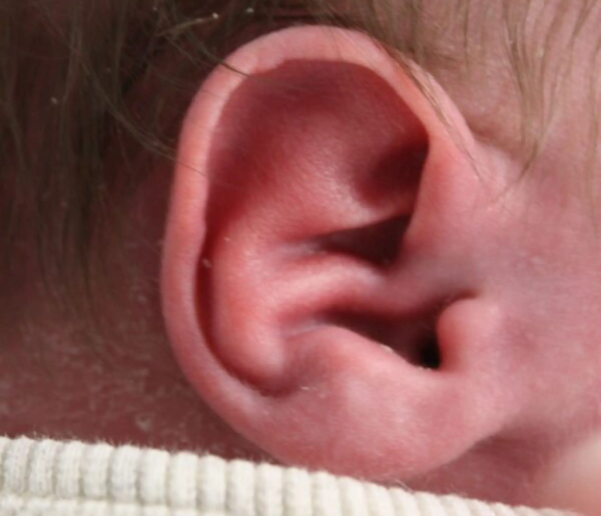 Earwell bij baby's voor