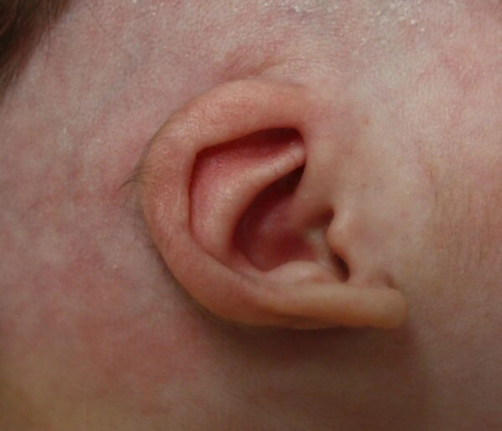Earwell bij baby's voor