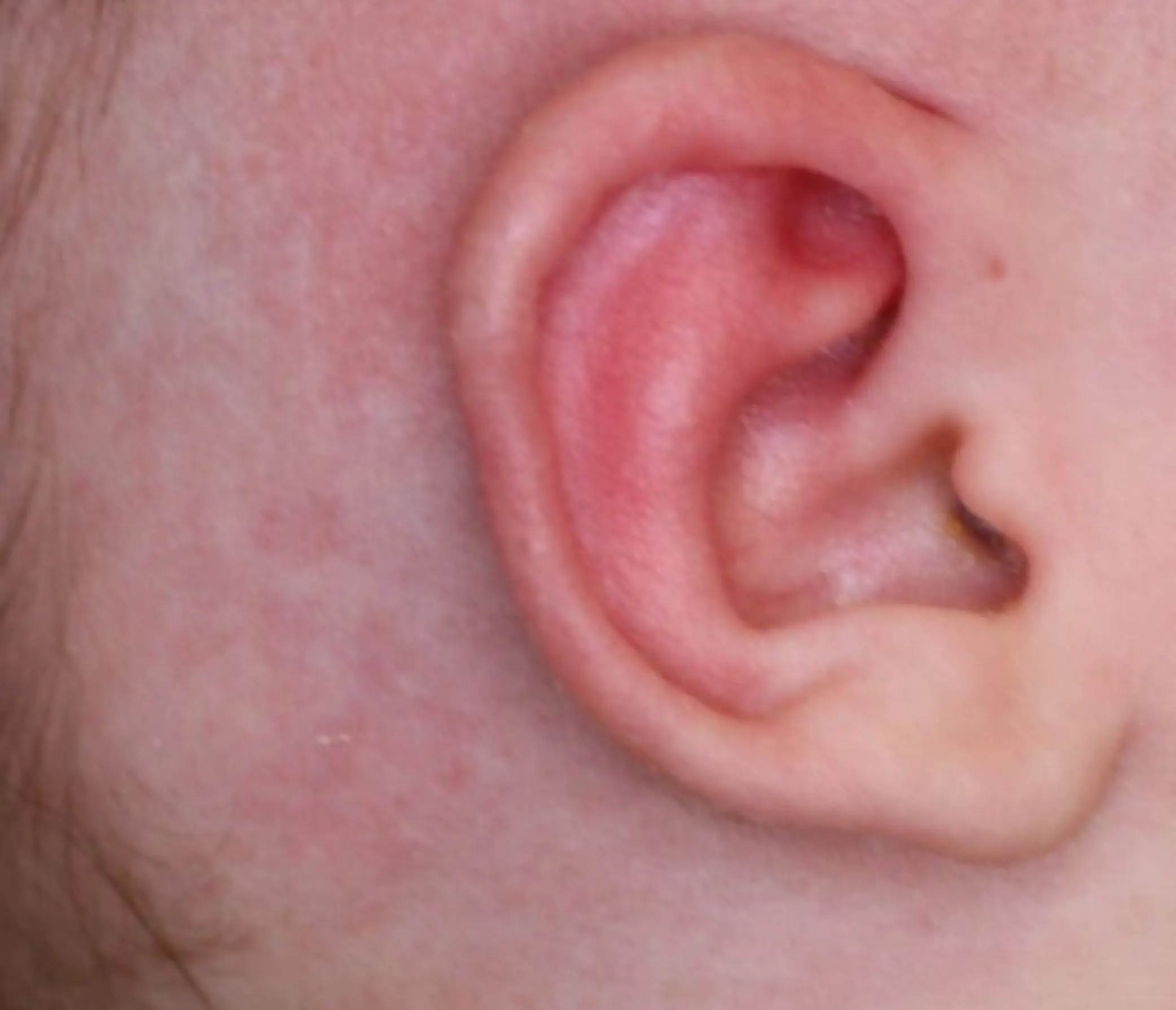 Earwell bij baby's na