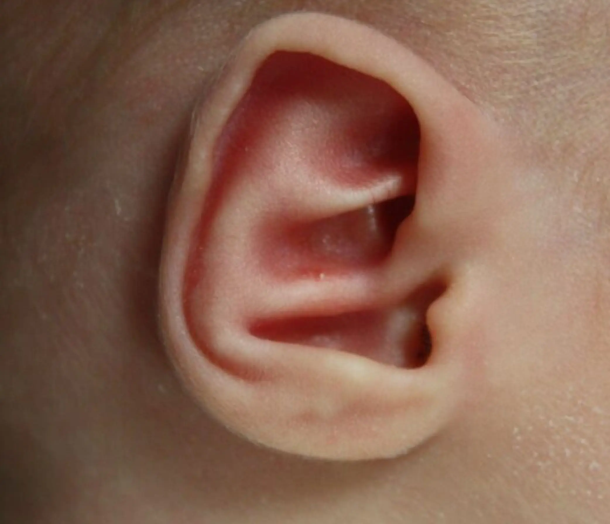 Earwell bij baby's voor
