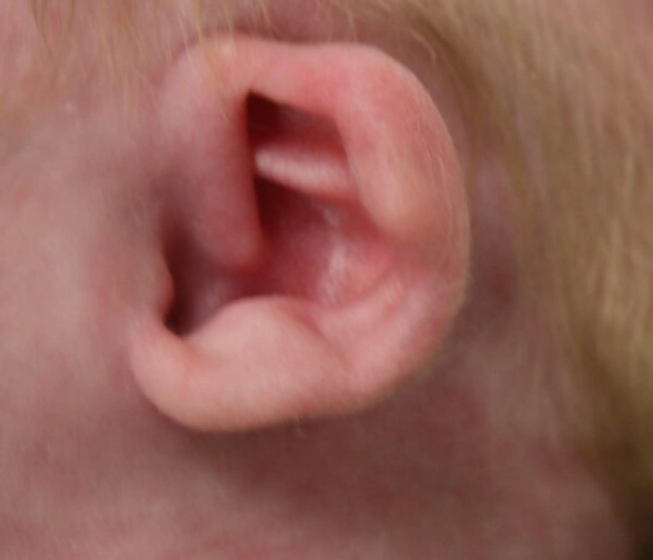 Earwell voor