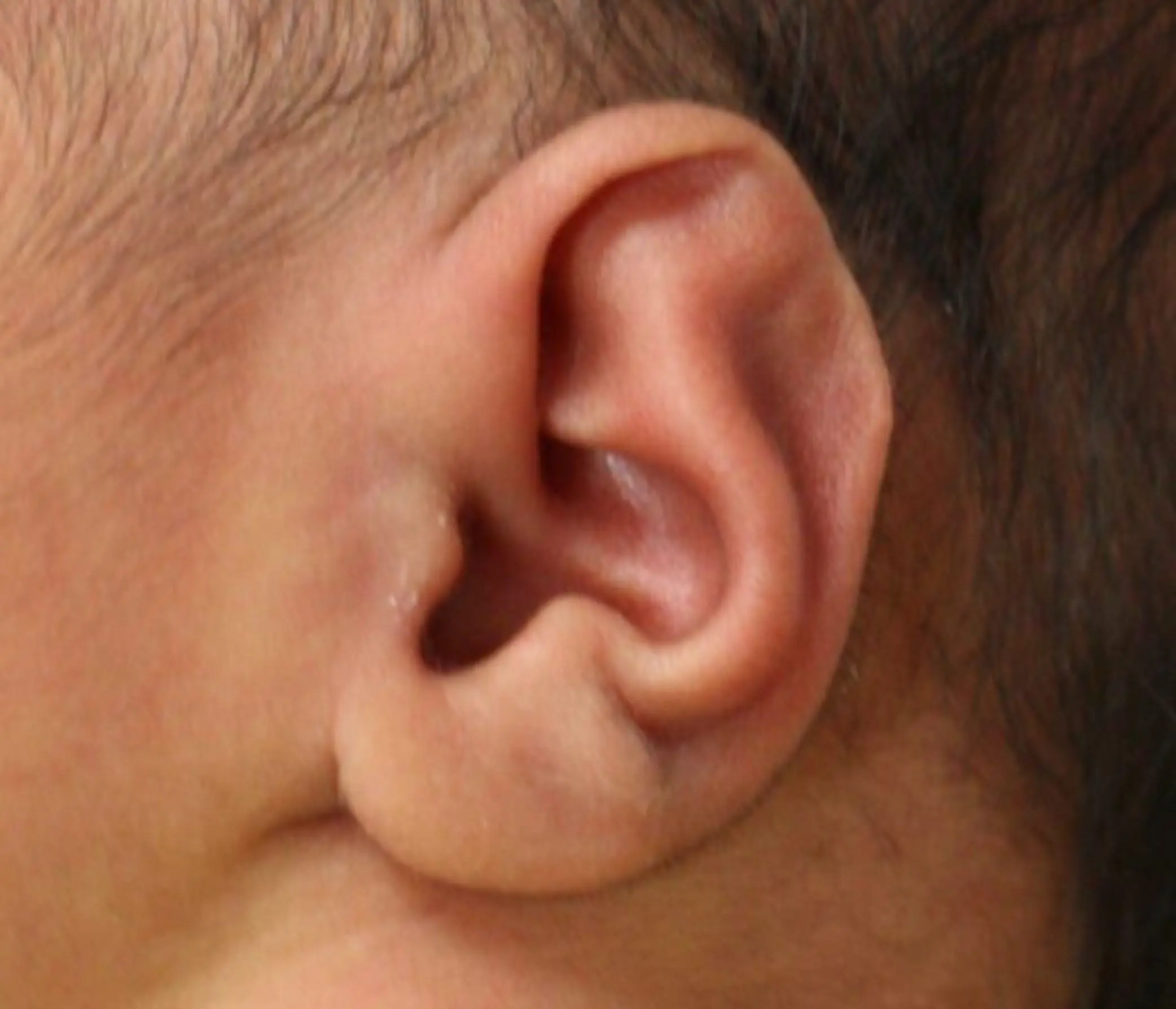 Earwell voor