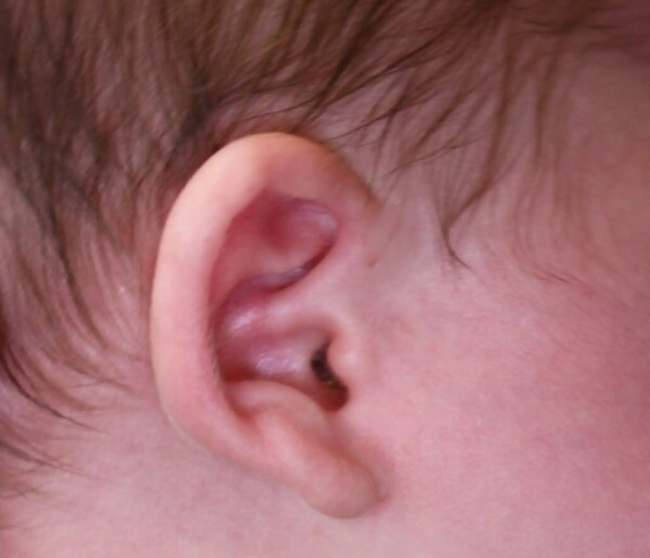 Earwell voor