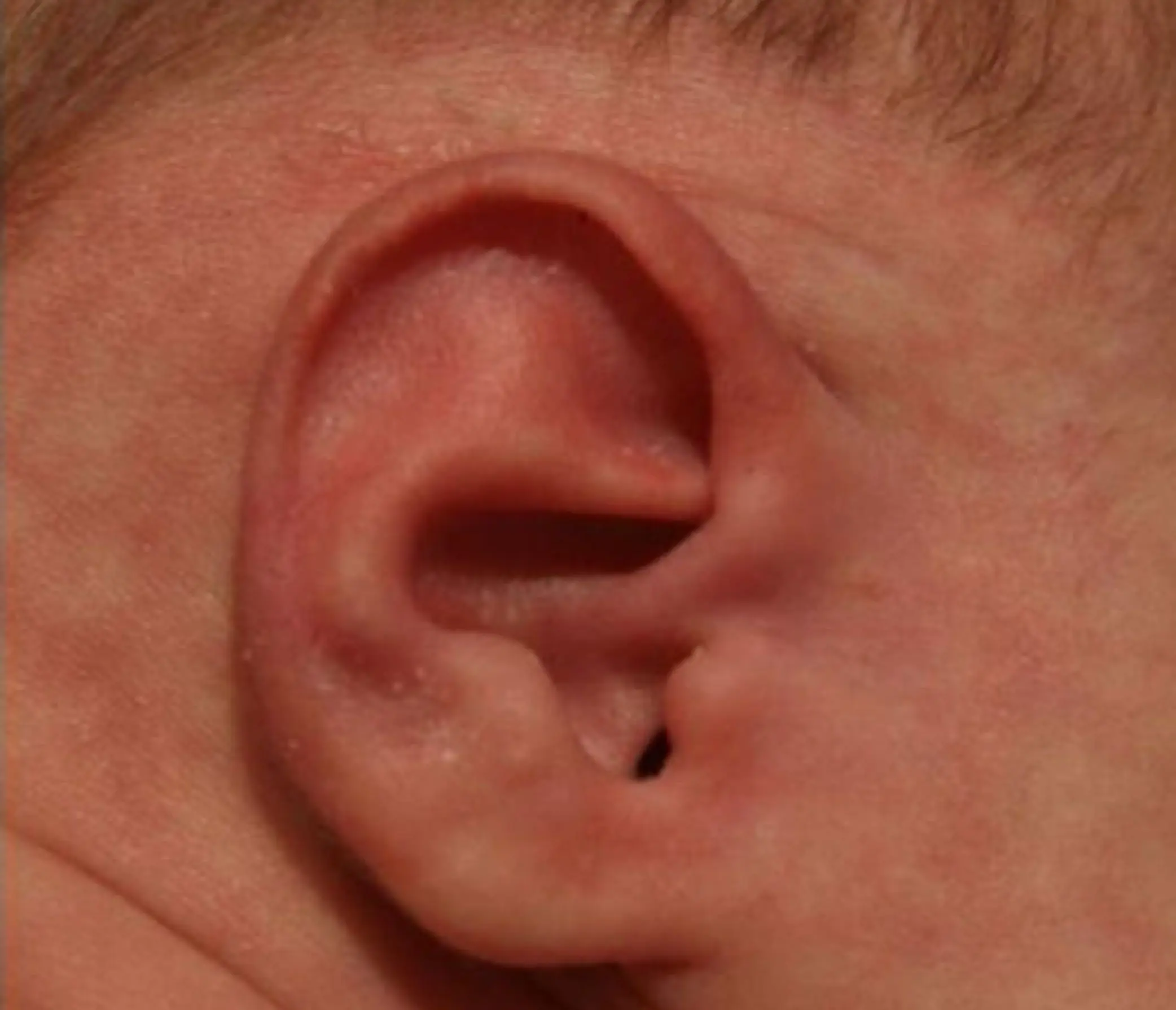 earwell