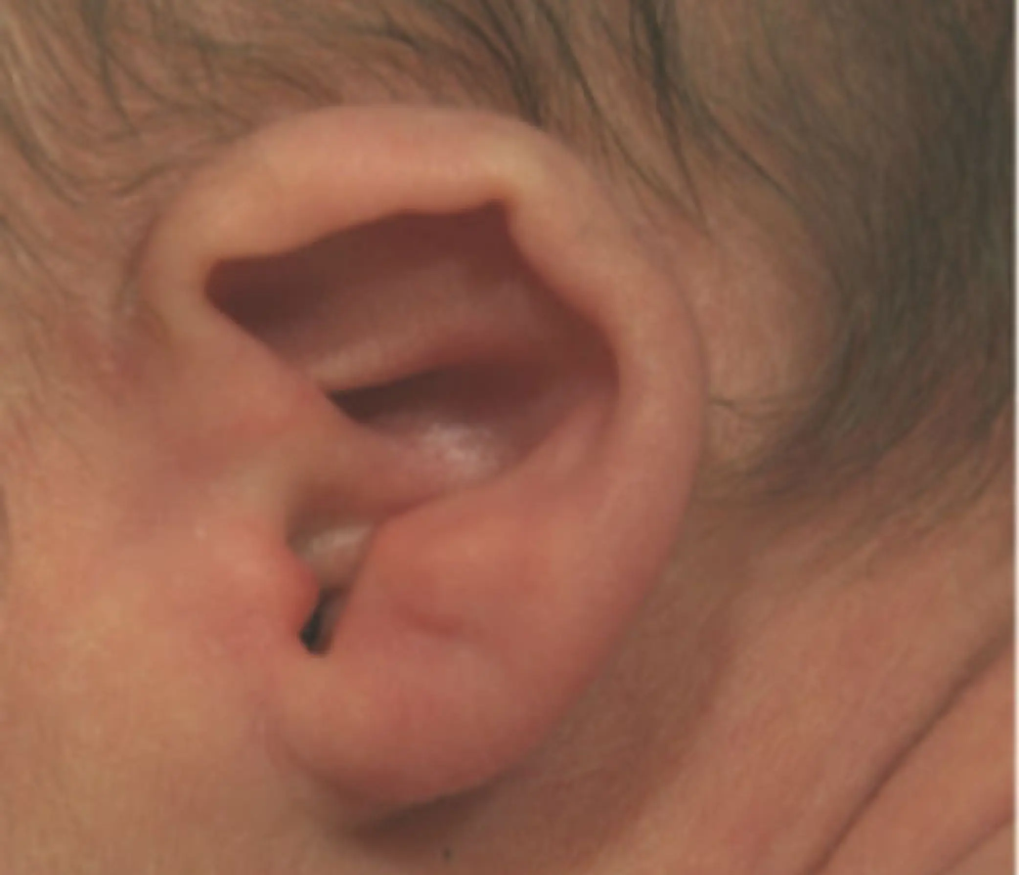 Earwell bij baby's voor