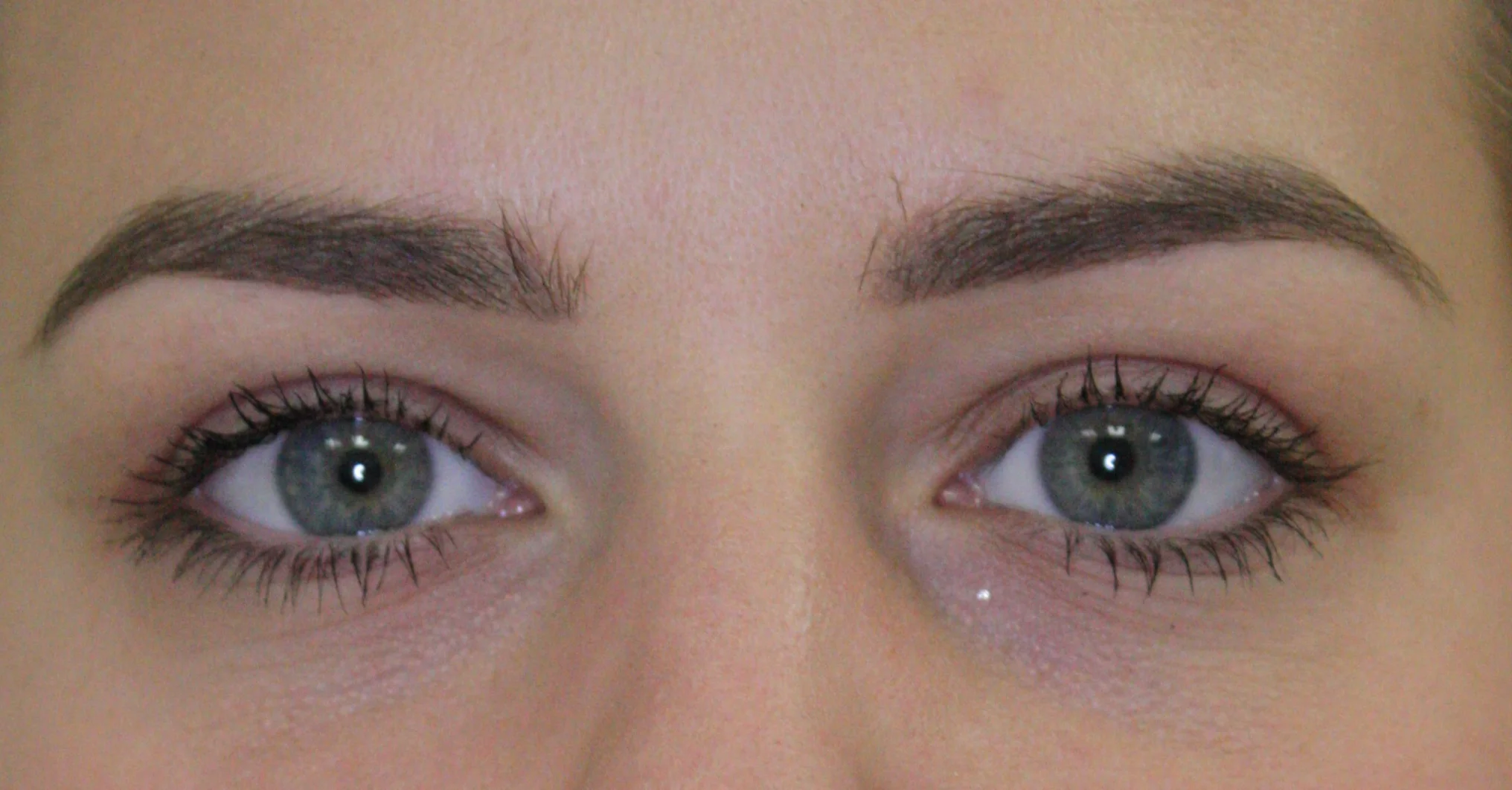 bovenooglidcorrectie na