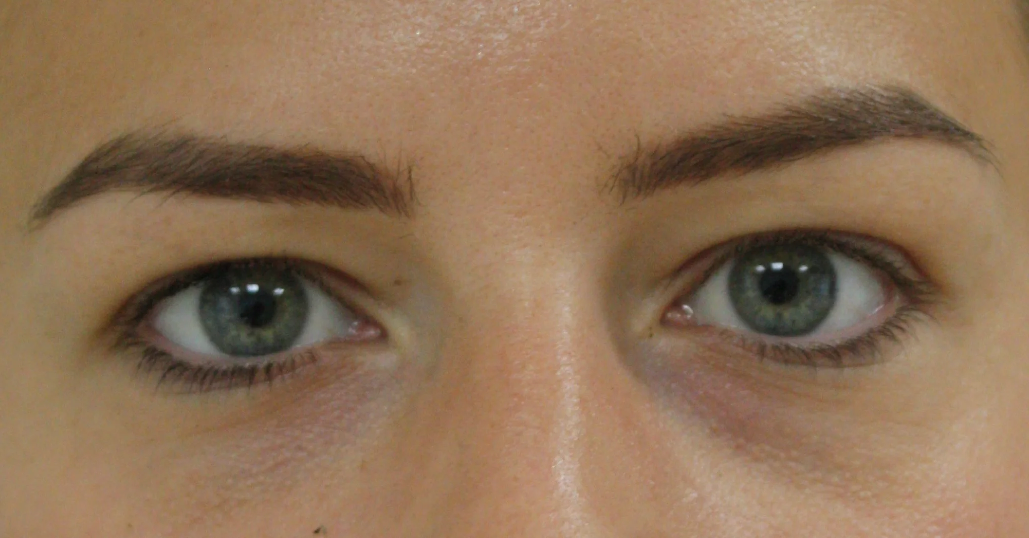 bovenooglidcorrectie voor