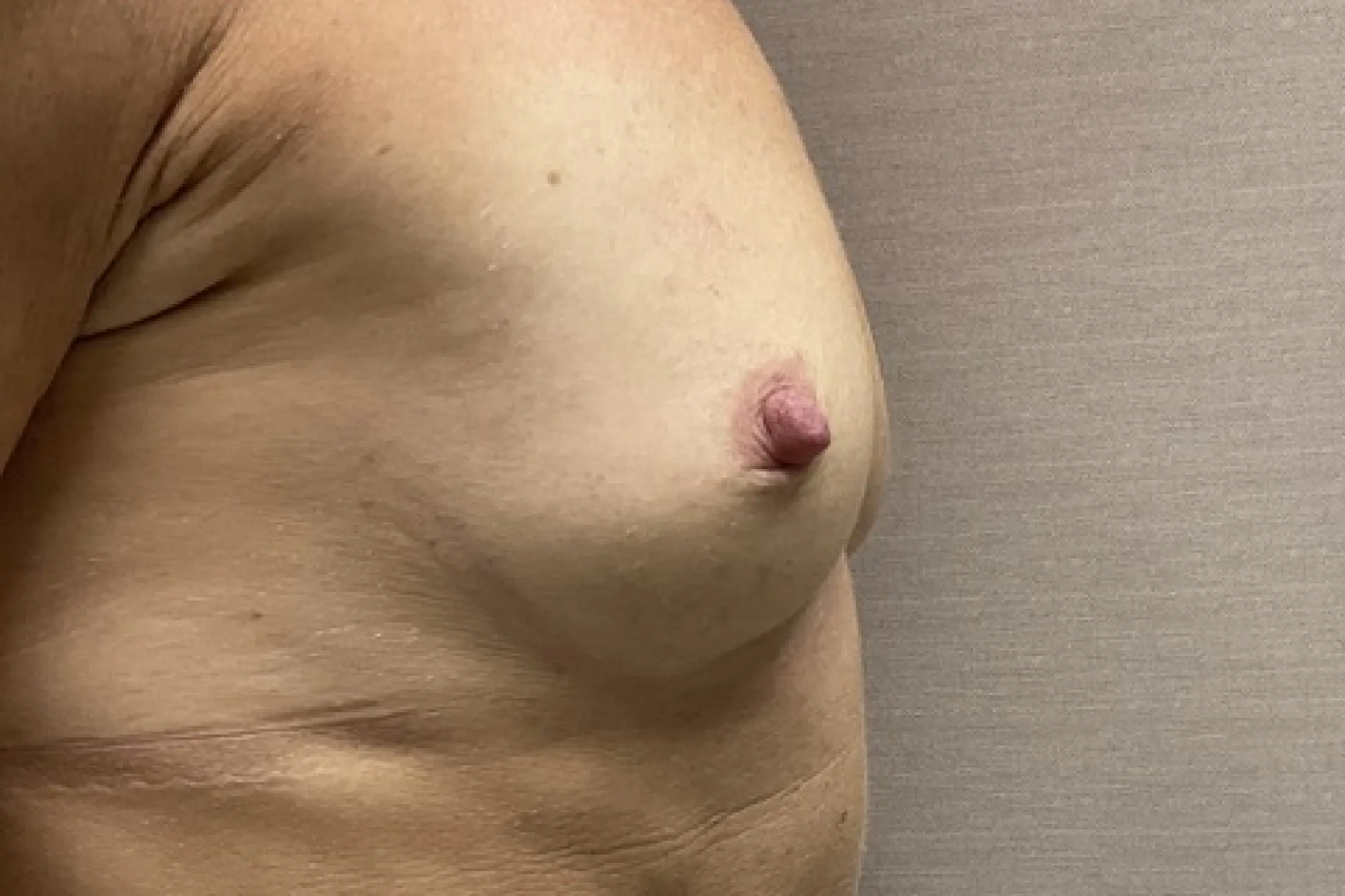 image (3).jpgpreserve1