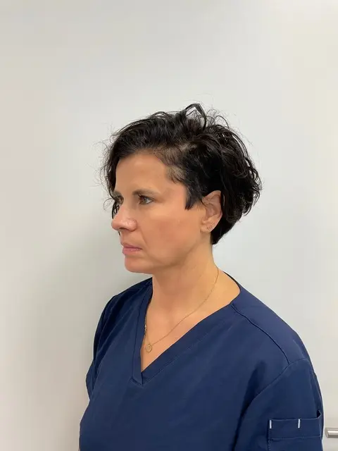 Endolift voor zijkant